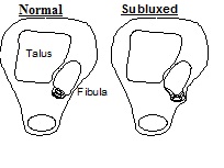 Peroneal Tendon