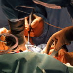 foot surgery