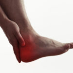 heel bursitis