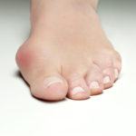signs bunion