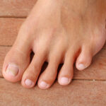 third toe