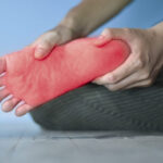 erythromelalgia